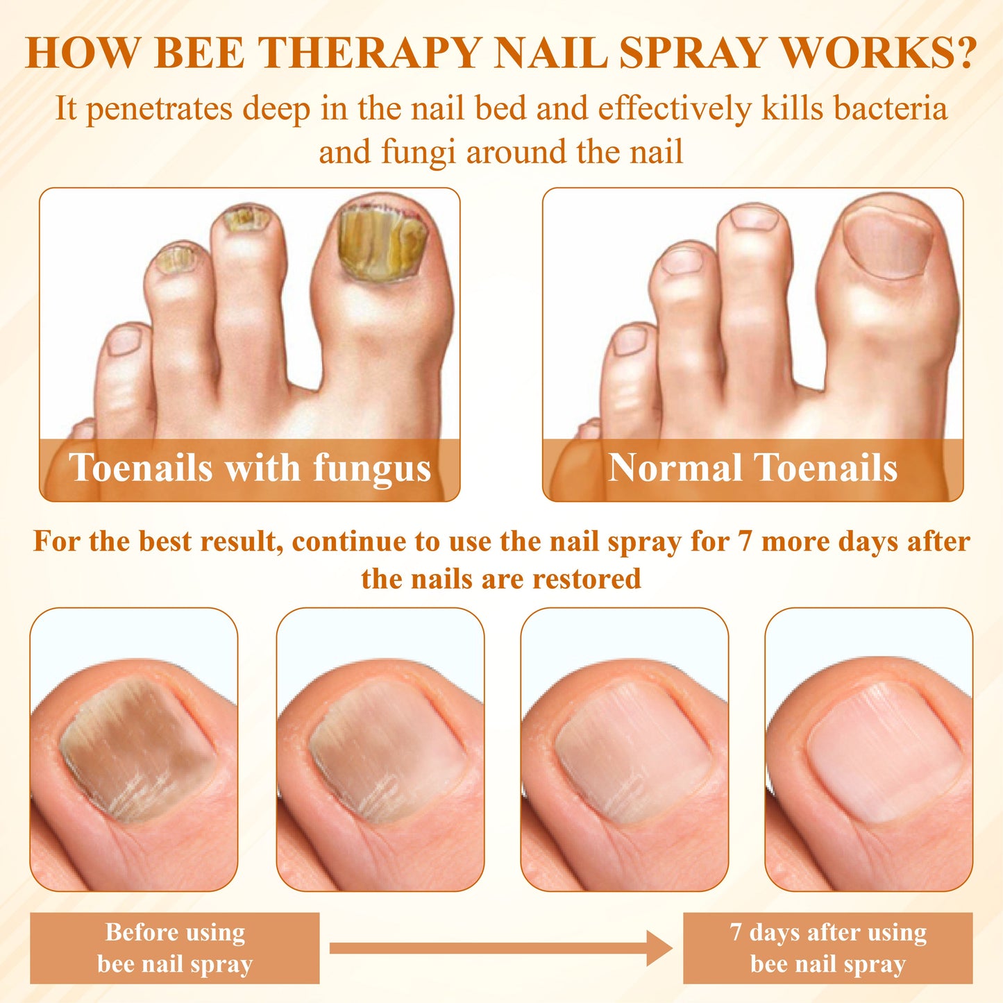 ATTDX® Fungiclear Bee Therapy Nail Spray