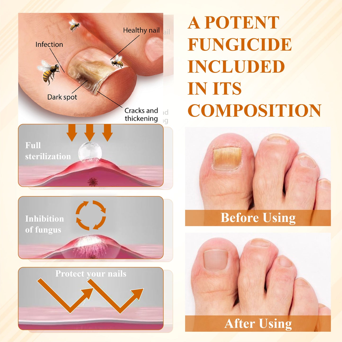 ATTDX® Fungiclear Bee Therapy Nail Spray