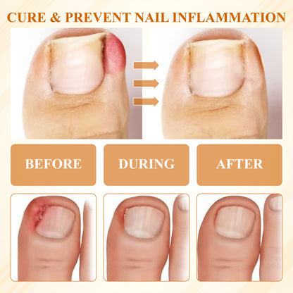 ATTDX® Fungiclear Bee Therapy Nail Spray