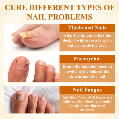 ATTDX® Fungiclear Bee Therapy Nail Spray