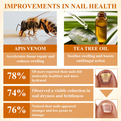 ATTDX® Fungiclear Bee Therapy Nail Spray