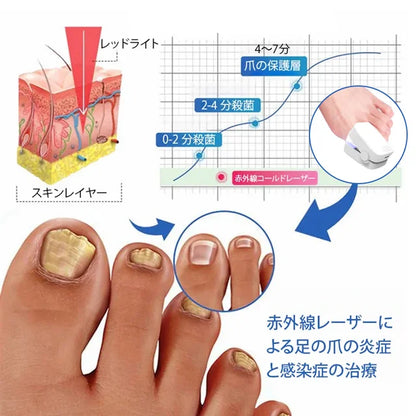 爪真菌対策レーザー治療器