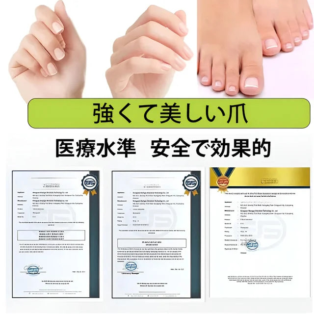 爪真菌対策レーザー治療器