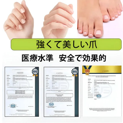 爪真菌対策レーザー治療器