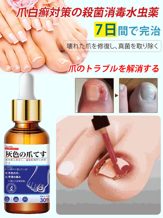 【14日間で爪水虫を根治】爪白癬対策の殺菌消毒水虫薬