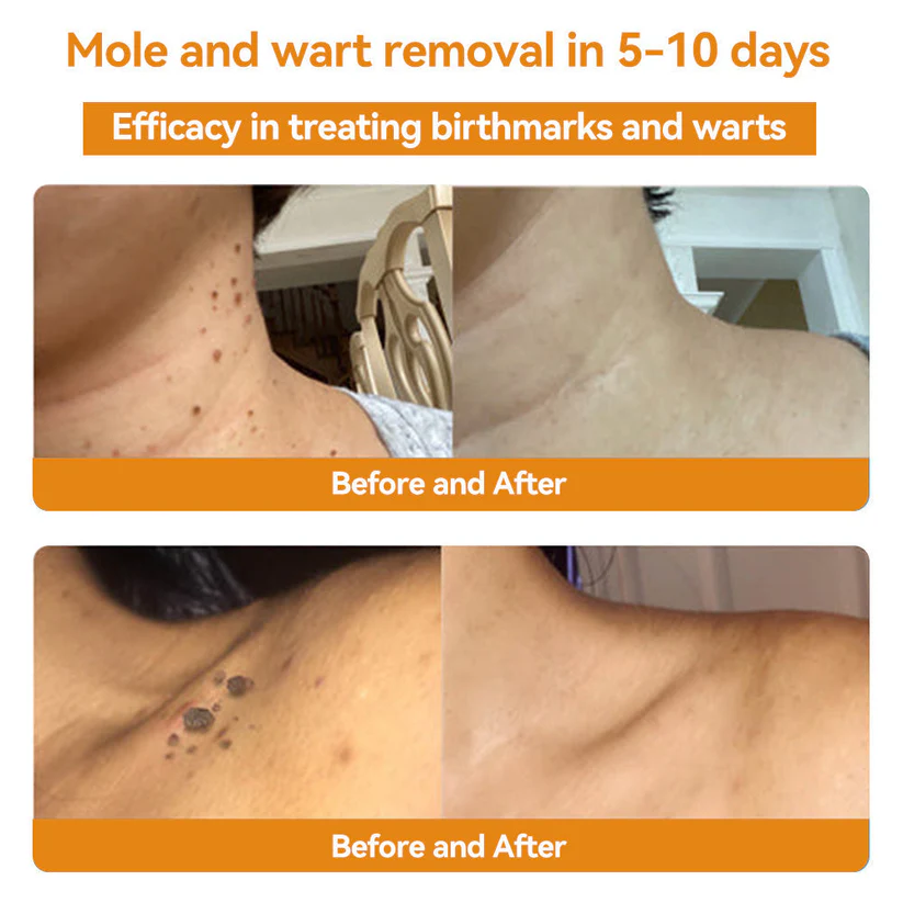 🏵️TLOPA®日本皮膚科学会推薦の蜂毒配合薬用スキンクリーム🔥